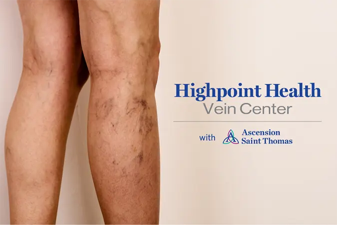 Highpoint Health Vein Center Now Open Highpoint Health Vein Center Now Open